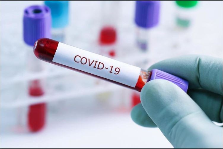 В Азербайджане число инфицированных коронавирусом достигло 40061, скончались 588 человек